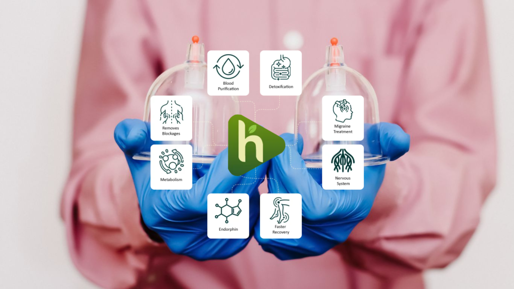 Benefits of hijama